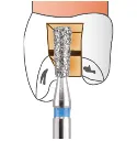 807  INVERTED CONE.webp