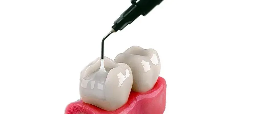 composite-ventura-bulkfill-flow-ii-35_2.webp