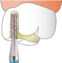 835, 836, 837 FLAT END CYLINDER.webp