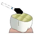 EX 3.webp