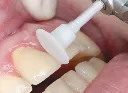 onegloss-ps.webp