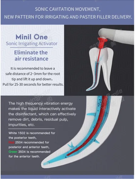 easyinsmile-endodontic-easydo-endo-activator-oral-mini-sonic-irrigator-with-45pc-soft-tips-dental-equipment- (4).webp
