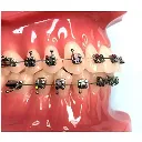 MorelliMaxBracketKitMBT022WithHook3454_903098d6-8d65-4fd0-91b6-805cf1f7764e.webp