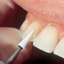 300Wx300H-arnolddental-108789.webp