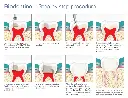 pulpitis_1.webp