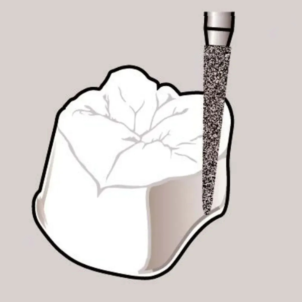 tapered-cone-diamond-bur.webp