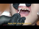 youtube - [Video]
