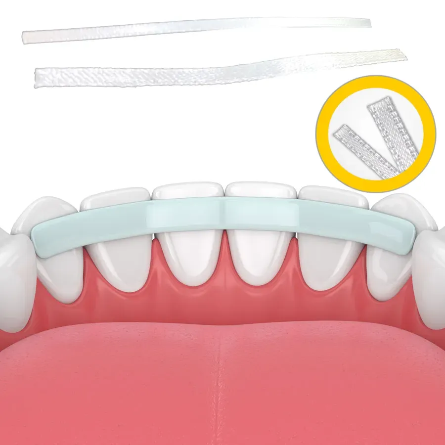 e-splint-11.webp