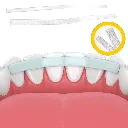 e-splint-11.webp