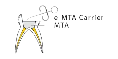 e-mta-step-3-e1686387148680.webp