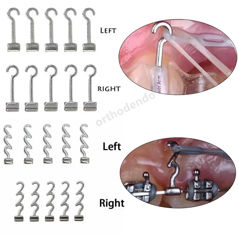 هوك تقويم  orthodontic sliding hook (خطاف أحادي - يمين)