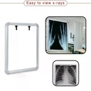 X- Ray Viewer