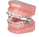 Class II Corrector